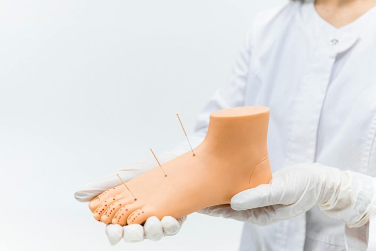A medical practitioner demonstrates acupuncture on a foot model, highlighting needle placement.