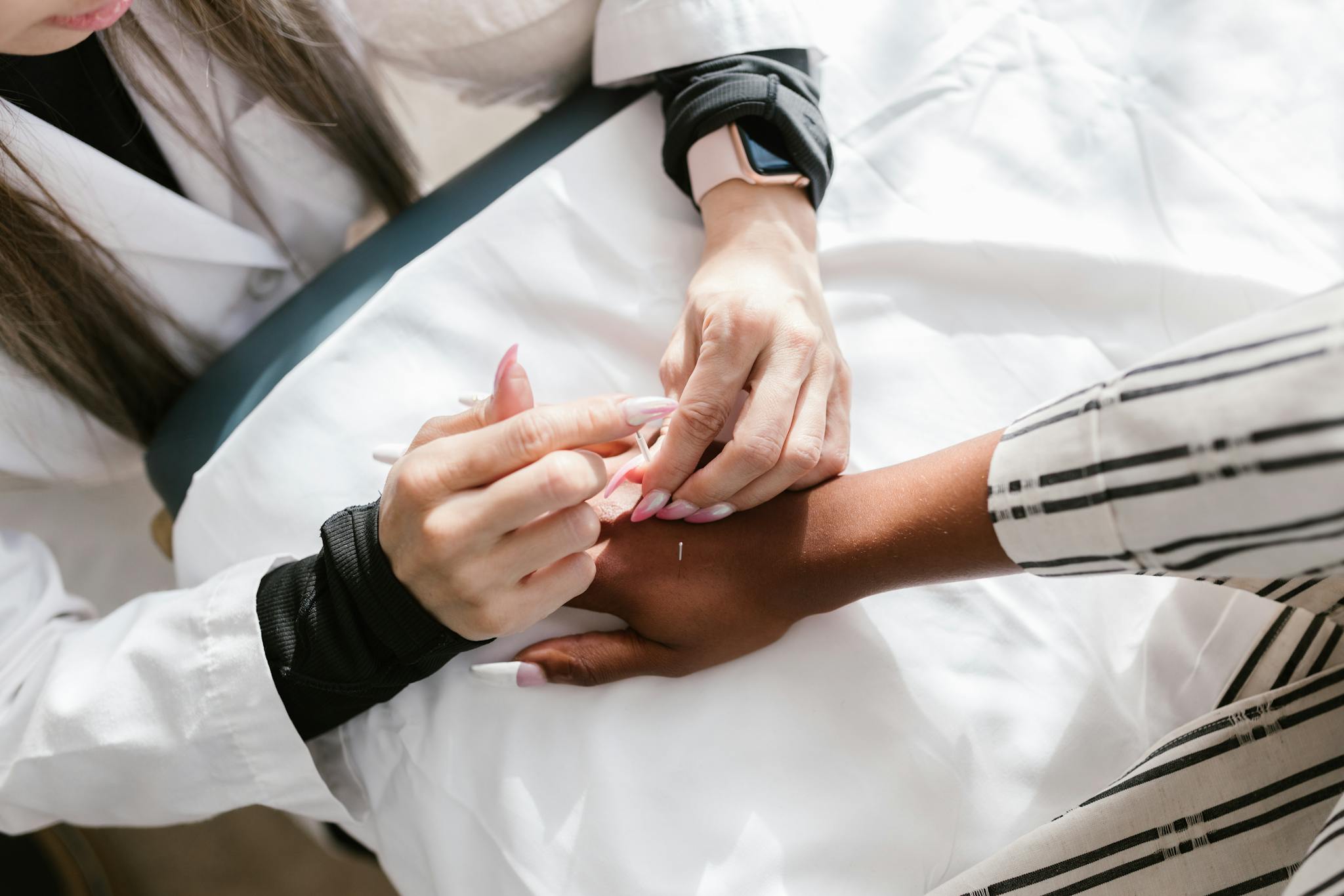 Close-up of a professional performing acupuncture therapy on a client's hand for wellness.